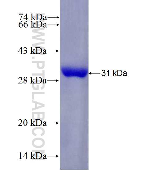 BCAM fusion protein Ag28193 SDS-PAGE
