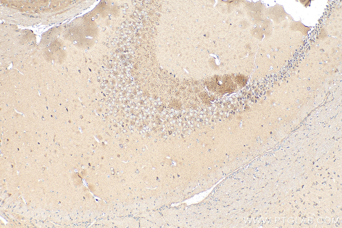 Immunohistochemistry (IHC) staining of mouse brain tissue using Brevican Polyclonal antibody (19017-1-AP)