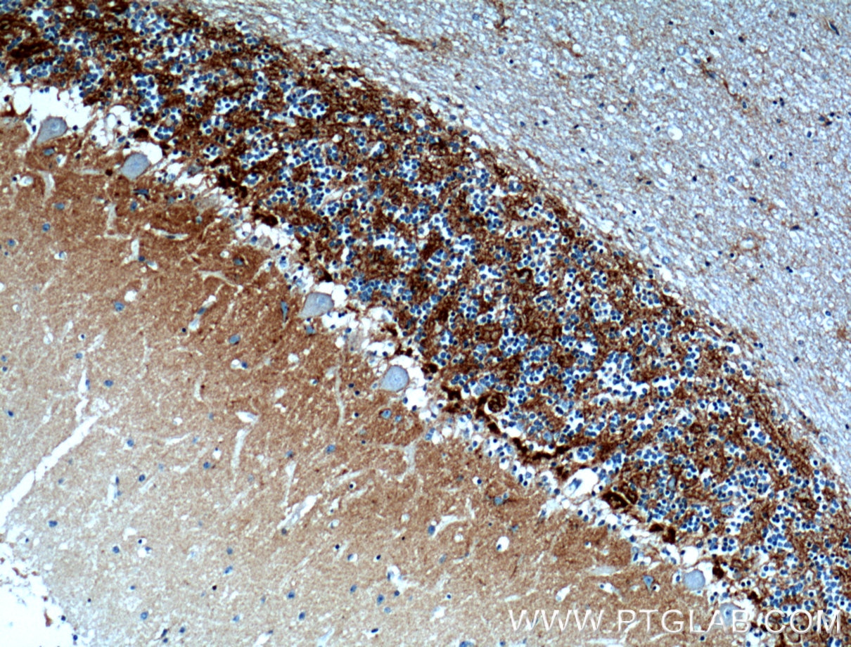 Immunohistochemistry (IHC) staining of human cerebellum tissue using Brevican Polyclonal antibody (19017-1-AP)