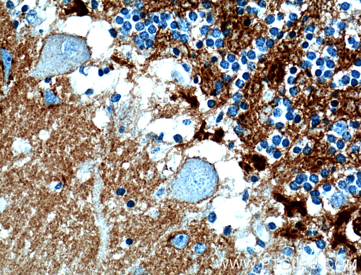 Immunohistochemistry (IHC) staining of human cerebellum tissue using Brevican Polyclonal antibody (19017-1-AP)