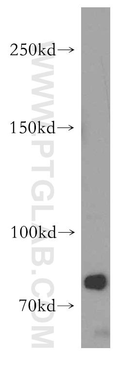 Western Blot (WB) analysis of COLO 320 cells using Brevican Polyclonal antibody (19017-1-AP)