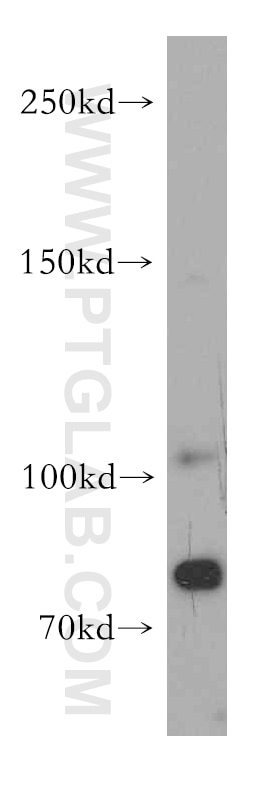 Western Blot (WB) analysis of Y79 cells using Brevican Polyclonal antibody (19017-1-AP)
