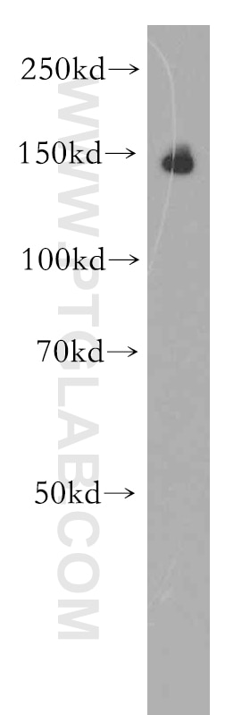 Western Blot (WB) analysis of human brain tissue using Brevican Polyclonal antibody (19017-1-AP)