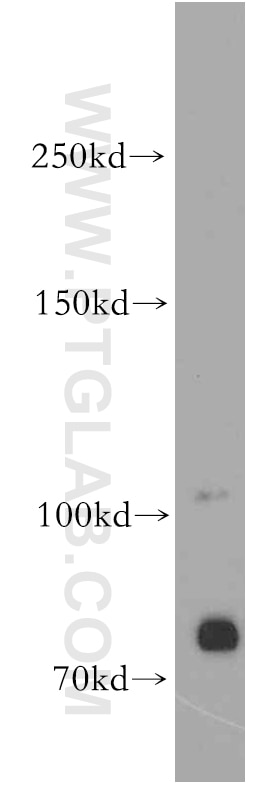 WB analysis of SH-SY5Y using 19017-1-AP