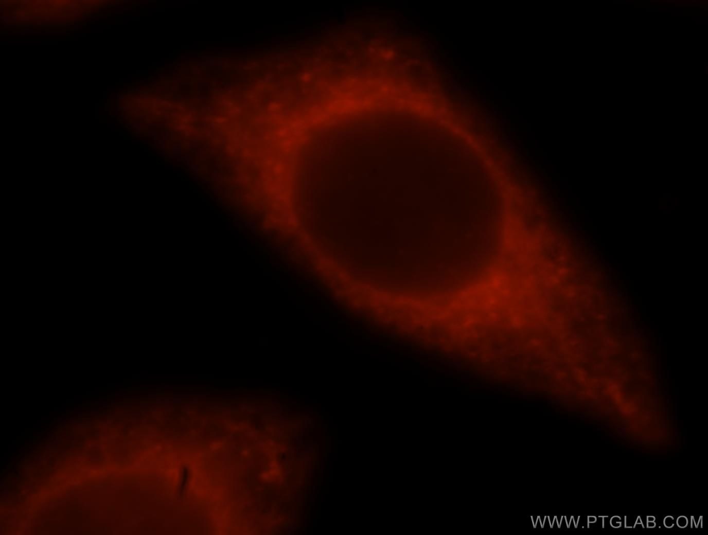 Immunofluorescence (IF) / fluorescent staining of HeLa cells using BAP29 Polyclonal antibody (15796-1-AP)