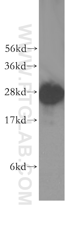 Western Blot (WB) analysis of COLO 320 cells using BAP29 Polyclonal antibody (15796-1-AP)