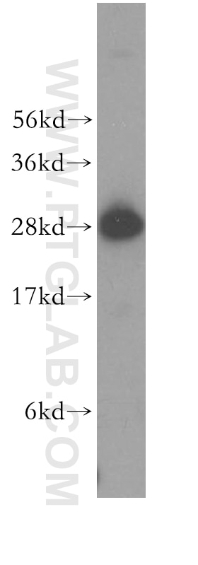 BAP29 Polyclonal antibody