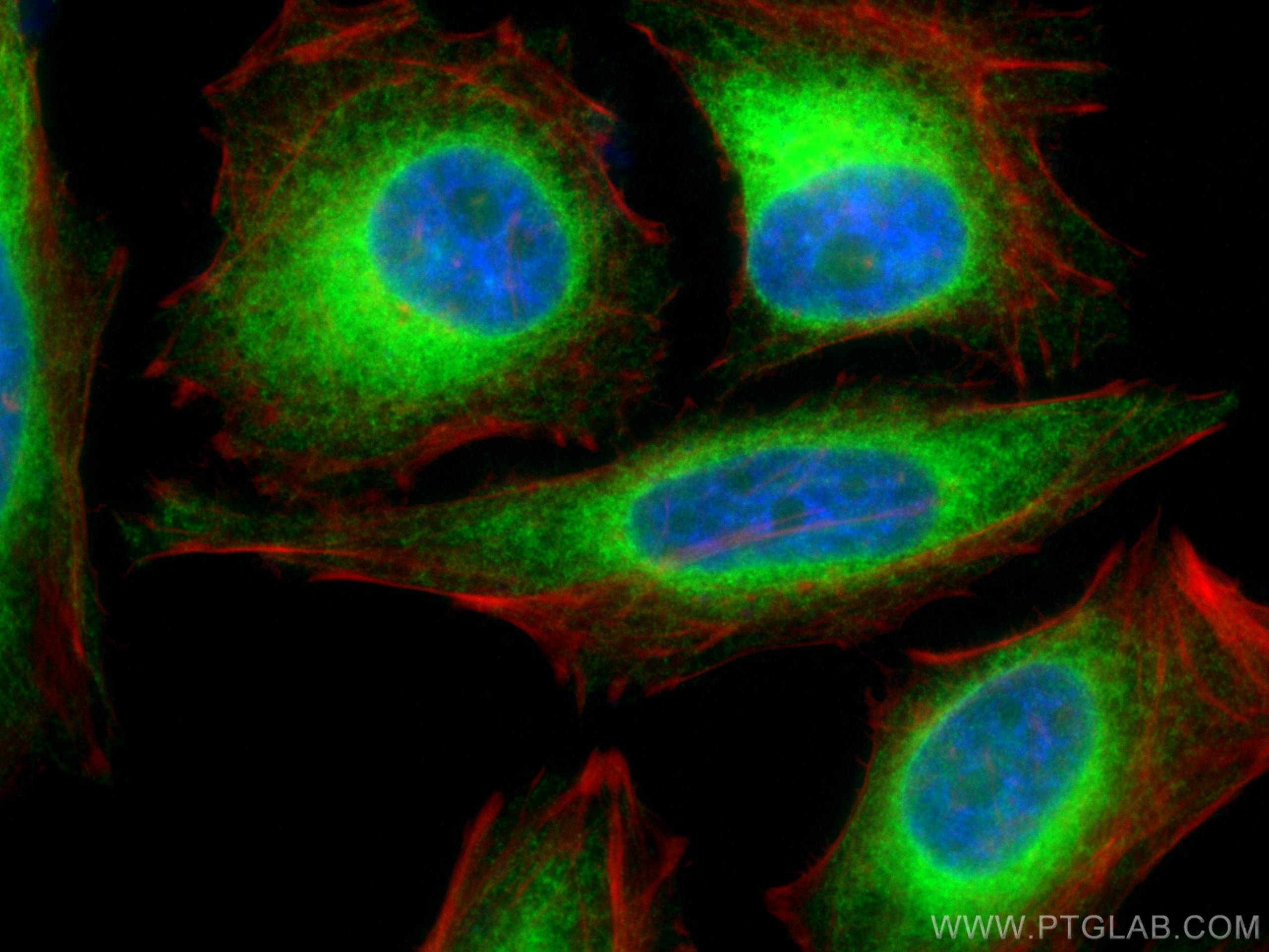 Immunofluorescence (IF) / fluorescent staining of HeLa cells using BAP31 Polyclonal antibody (11200-1-AP)