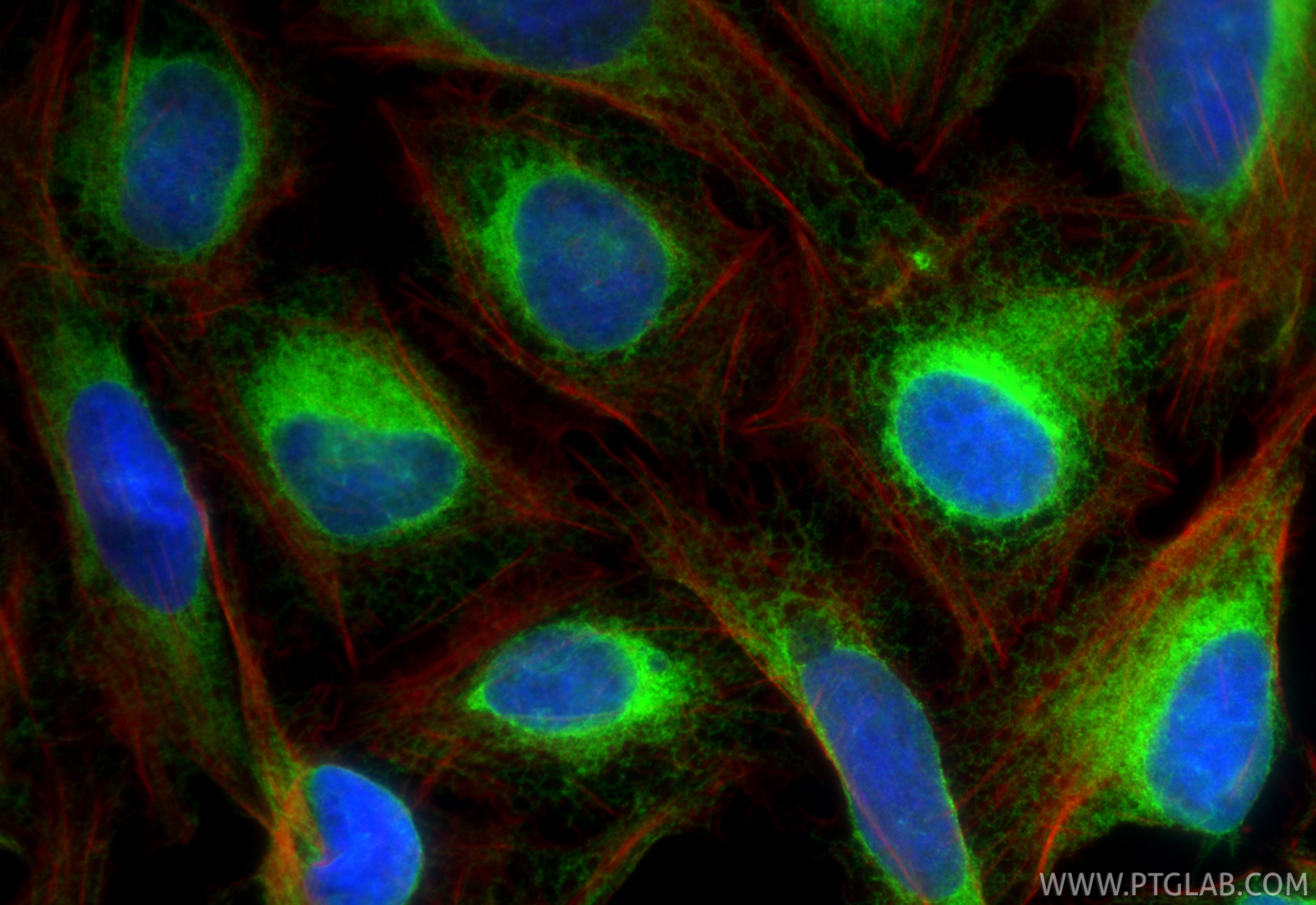 IF Staining of U2OS using 11200-1-AP Immunofluorescence (IF) / fluorescent staining of U2OS cells using BAP31 Polyclonal antibody (11200-1-AP)