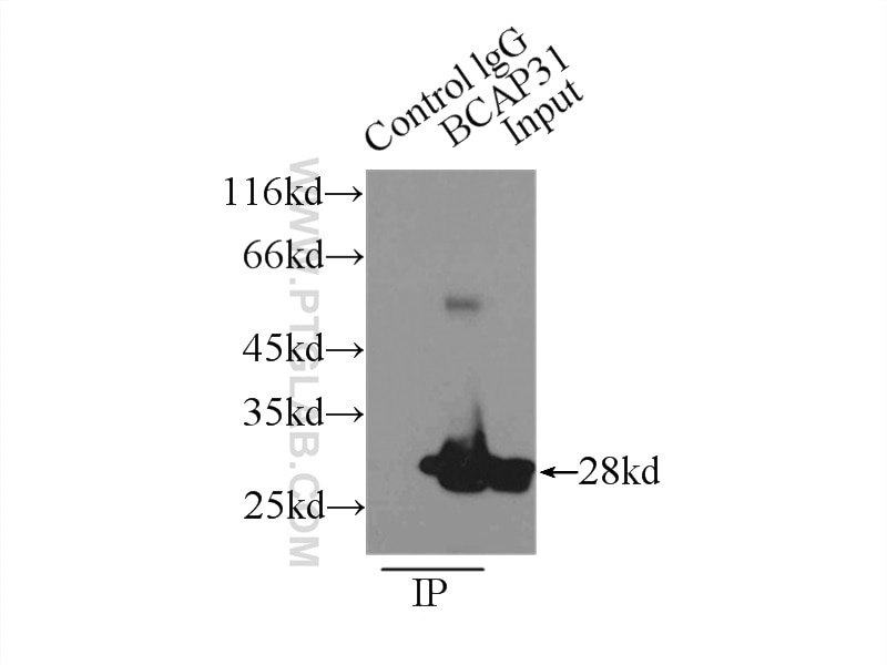Immunoprecipitation (IP) experiment of A431 cells using BAP31 Polyclonal antibody (11200-1-AP)
