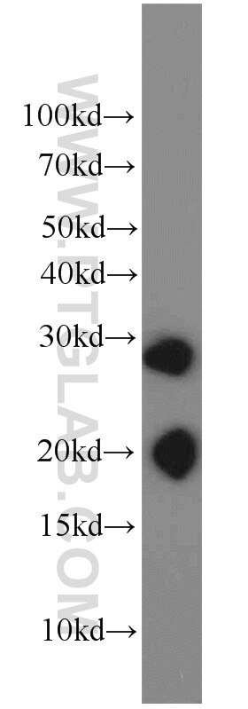 Western Blot (WB) analysis of human placenta tissue using BAP31 Polyclonal antibody (11200-1-AP)