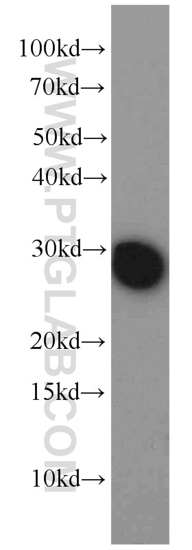 Western Blot (WB) analysis of HEK-293 cells using BAP31 Polyclonal antibody (11200-1-AP)