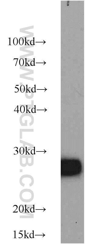 Western Blot (WB) analysis of A431 cells using BAP31 Polyclonal antibody (11200-1-AP)