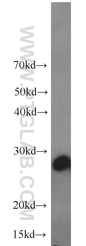 Western Blot (WB) analysis of HeLa cells using BAP31 Polyclonal antibody (11200-1-AP)