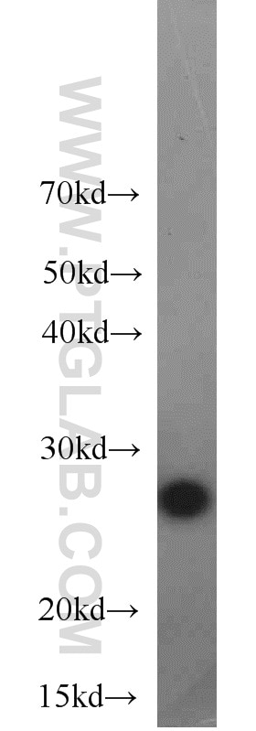 Western Blot (WB) analysis of mouse placenta tissue using BAP31 Polyclonal antibody (11200-1-AP)