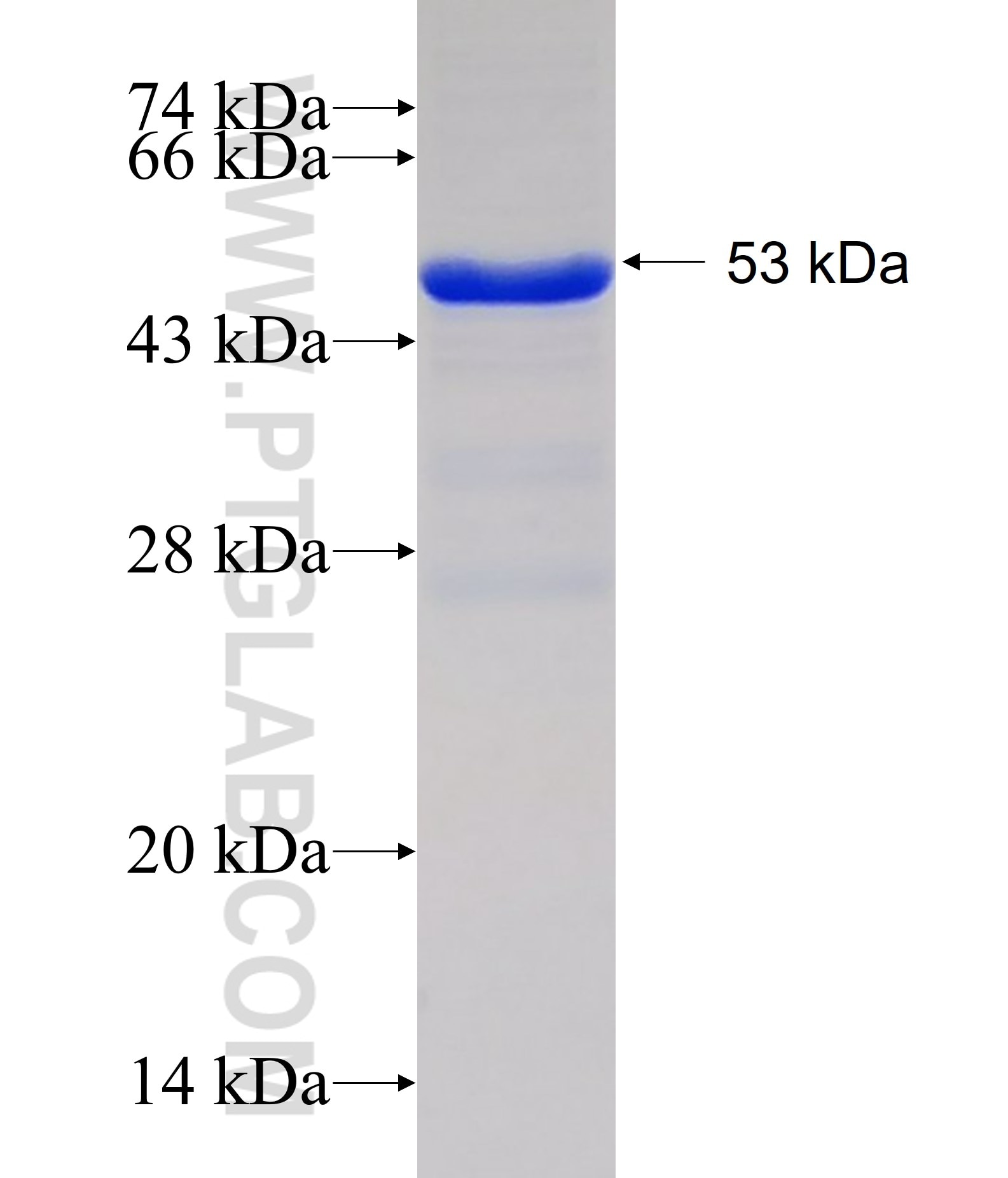 BCAP31 fusion protein Ag1668 SDS-PAGE