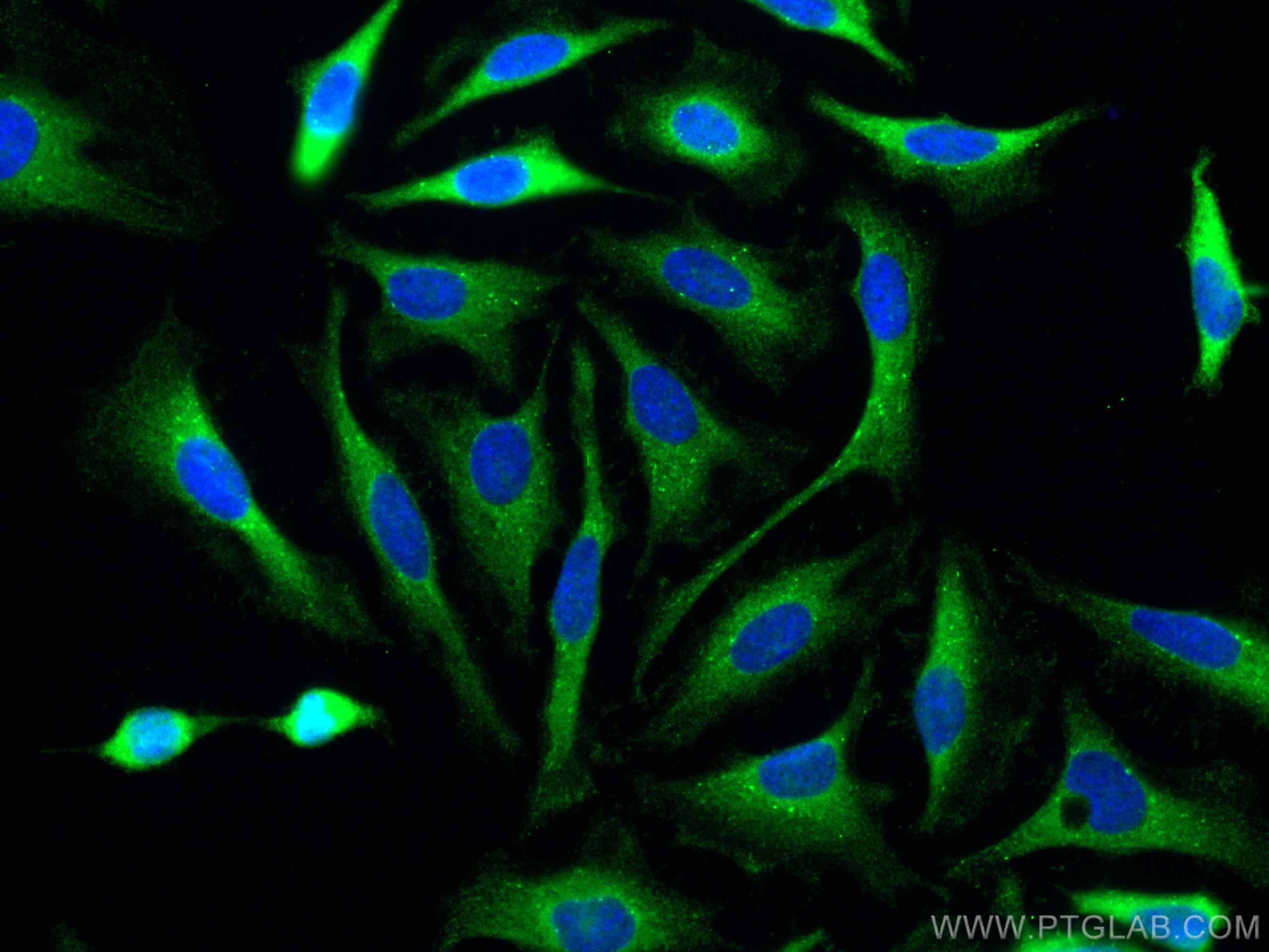 Immunofluorescence (IF) / fluorescent staining of HeLa cells using p130Cas / BCAR1 Polyclonal antibody (16815-1-AP)