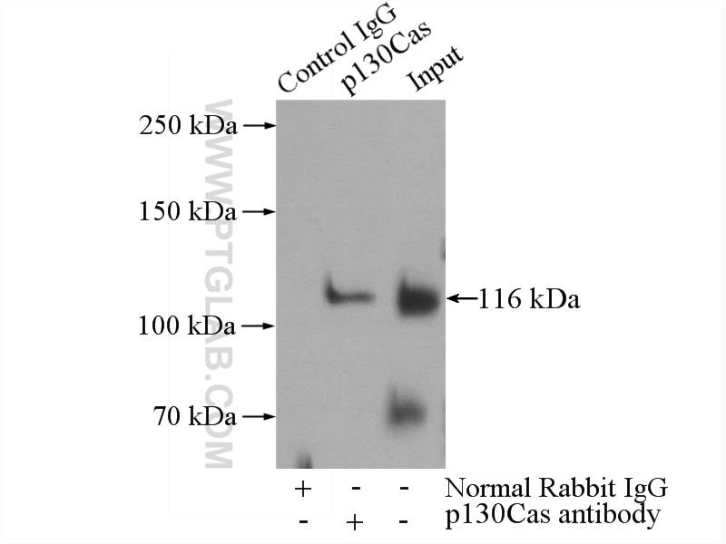 Immunoprecipitation (IP) experiment of RAW 264.7 cells using p130Cas / BCAR1 Polyclonal antibody (16815-1-AP)