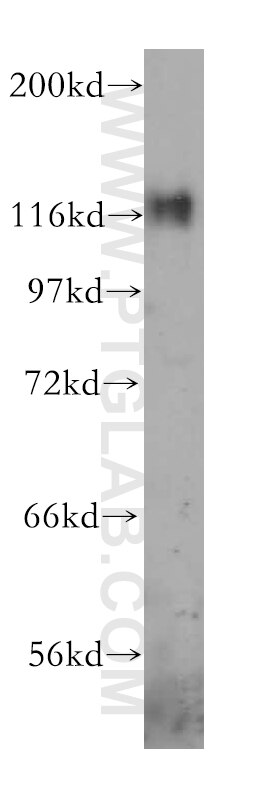 Western Blot (WB) analysis of A431 cells using p130Cas / BCAR1 Polyclonal antibody (16815-1-AP)