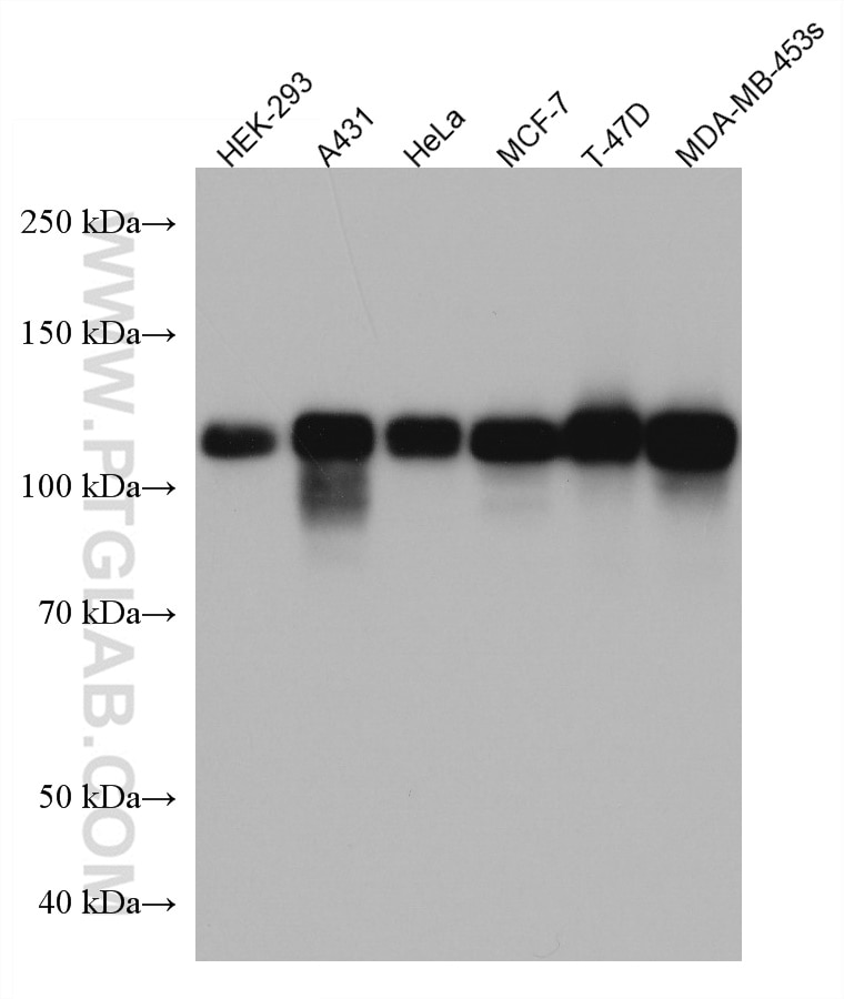 WB analysis using 67215-1-Ig