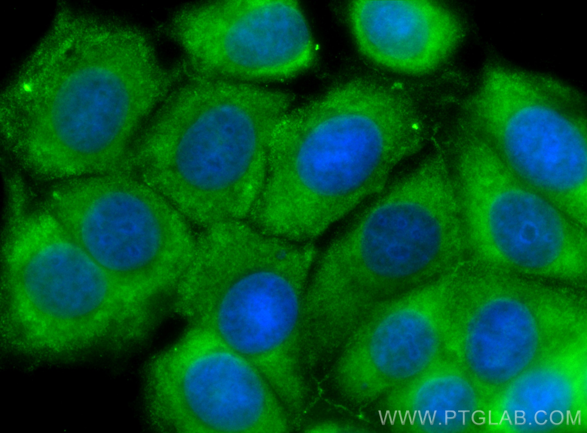 Immunofluorescence (IF) / fluorescent staining of MCF-7 cells using CoraLite® Plus 488-conjugated p130Cas / BCAR1 Mono (CL488-67215)