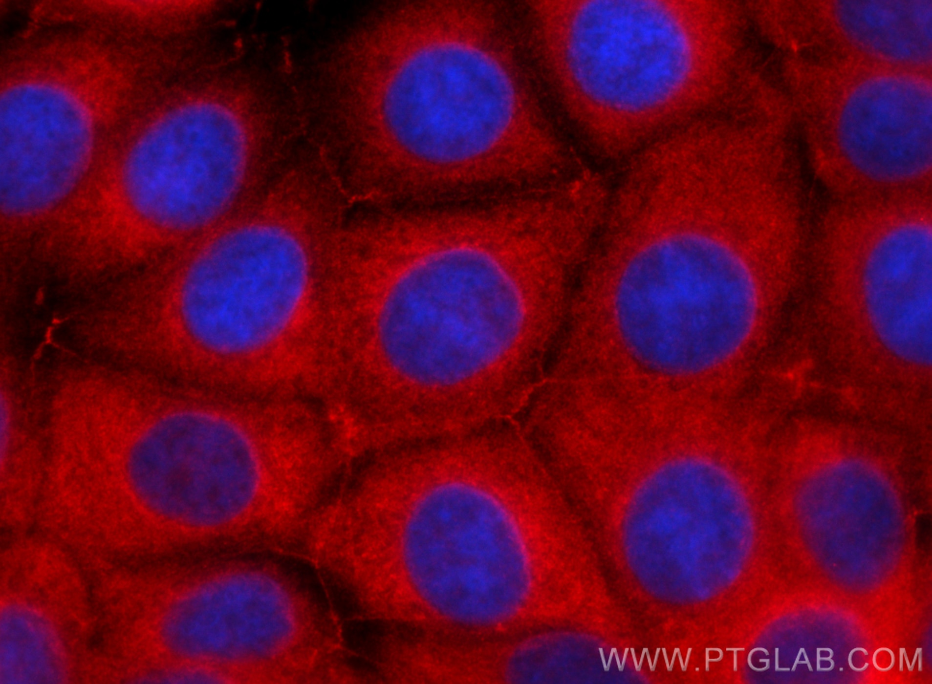 Immunofluorescence (IF) / fluorescent staining of MCF-7 cells using CoraLite®594-conjugated p130Cas / BCAR1 Monoclonal (CL594-67215)