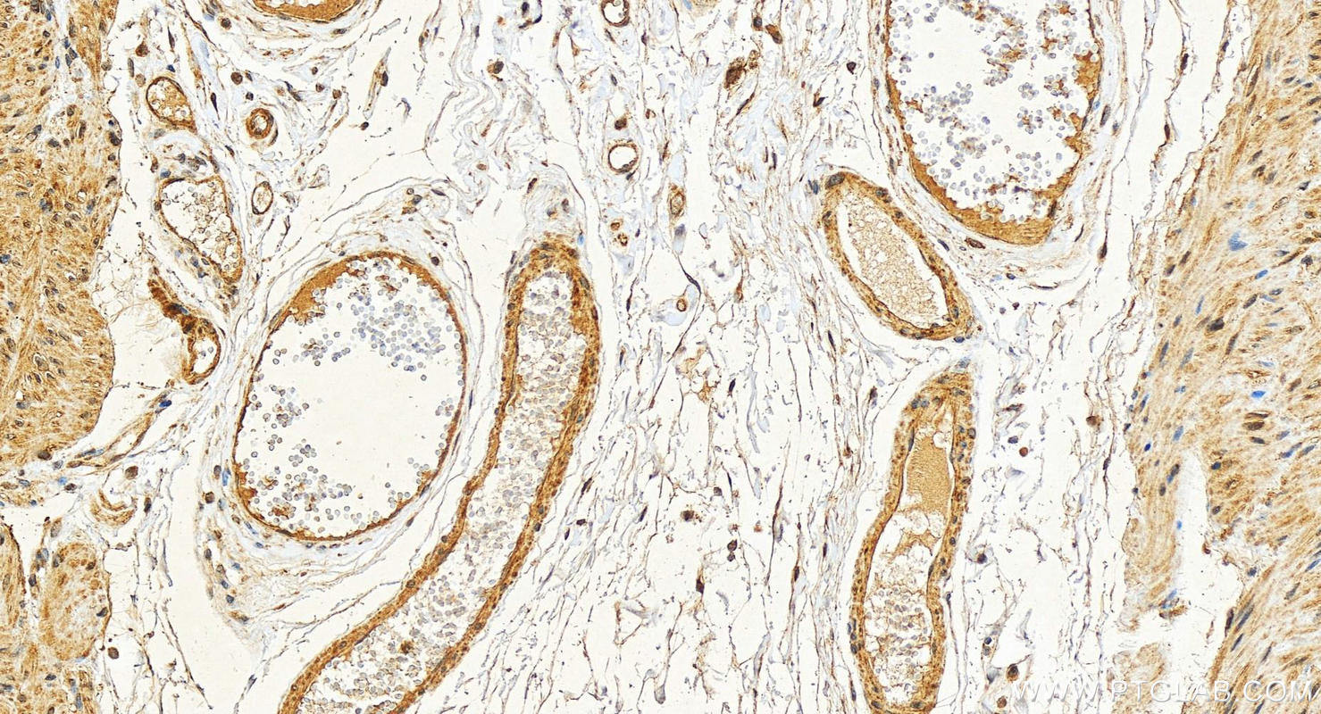 Immunohistochemistry (IHC) staining of human stomach tissue using BCAS1 Polyclonal antibody (25776-1-AP)