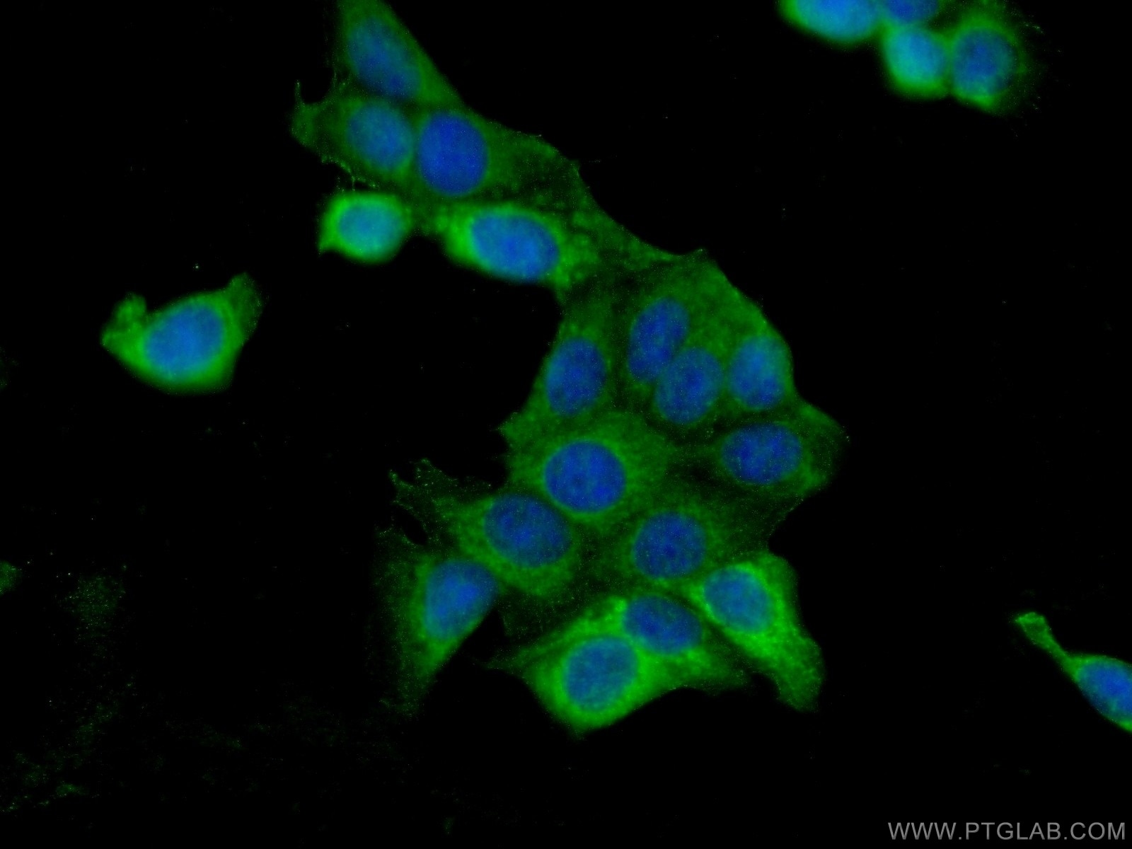 Immunofluorescence (IF) / fluorescent staining of MCF-7 cells using BCAS1 Polyclonal antibody (25776-1-AP)