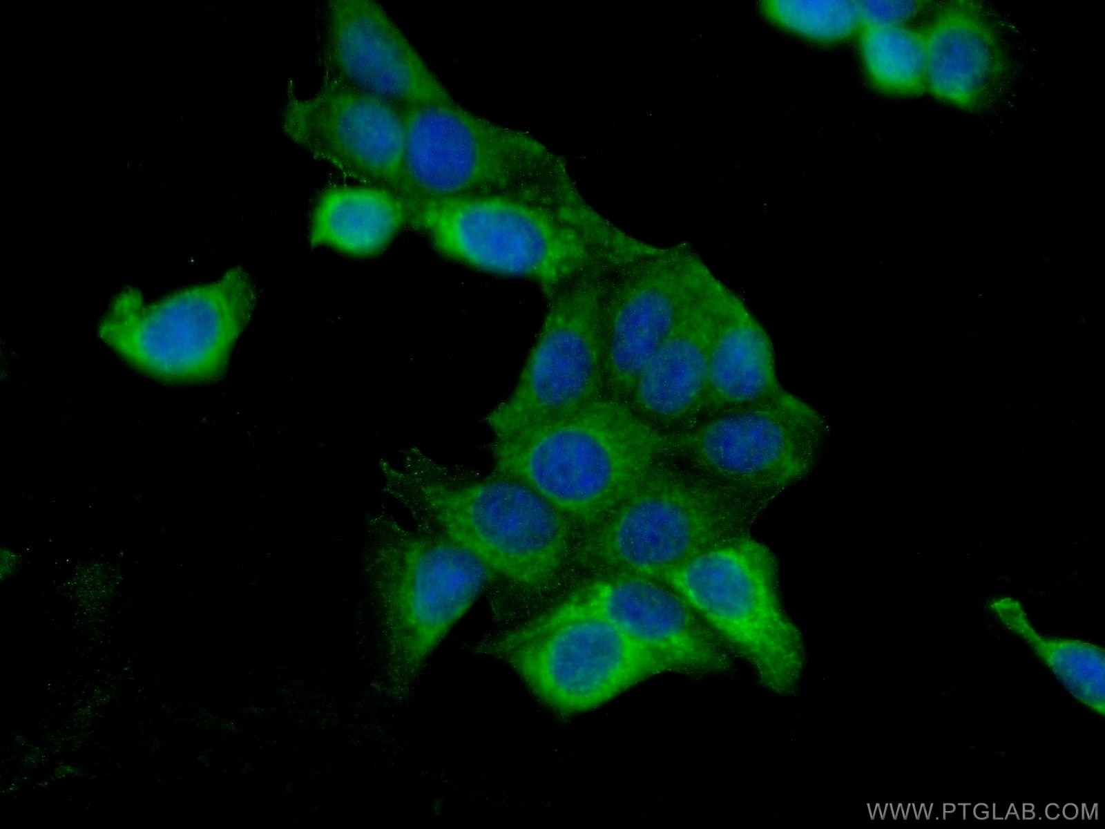 IF Staining of MCF-7 using 25776-1-AP