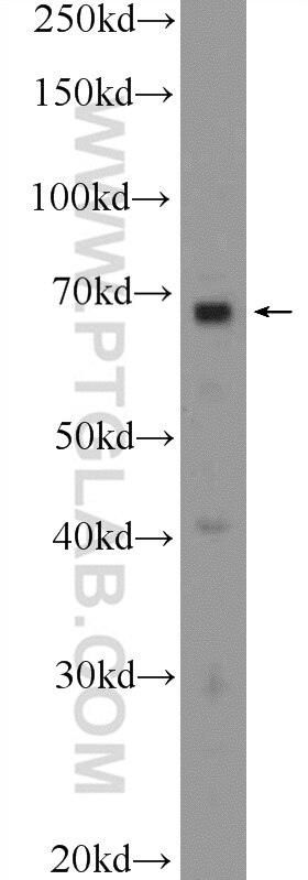 Western Blot (WB) analysis of MCF-7 cells using BCAS1 Polyclonal antibody (25776-1-AP)