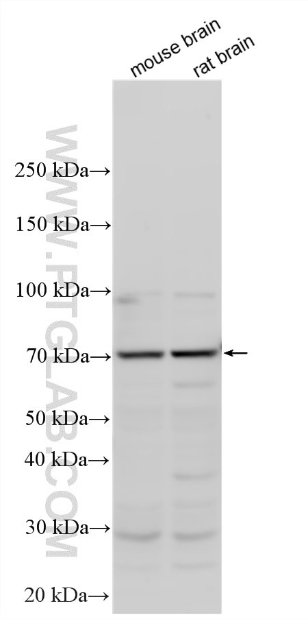 Various lysates were subjected to SDS PAGE followed by western blot with 25776-1-AP (BCAS1 antibody) at dilution of 1:500 incubated at room temperature for 1.5 hours. Western Blot (WB) analysis of various lysates using BCAS1 Polyclonal antibody (25776-1-AP)
