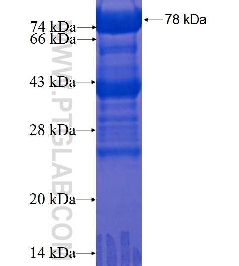 BCAS1 fusion protein Ag22760 SDS-PAGE
