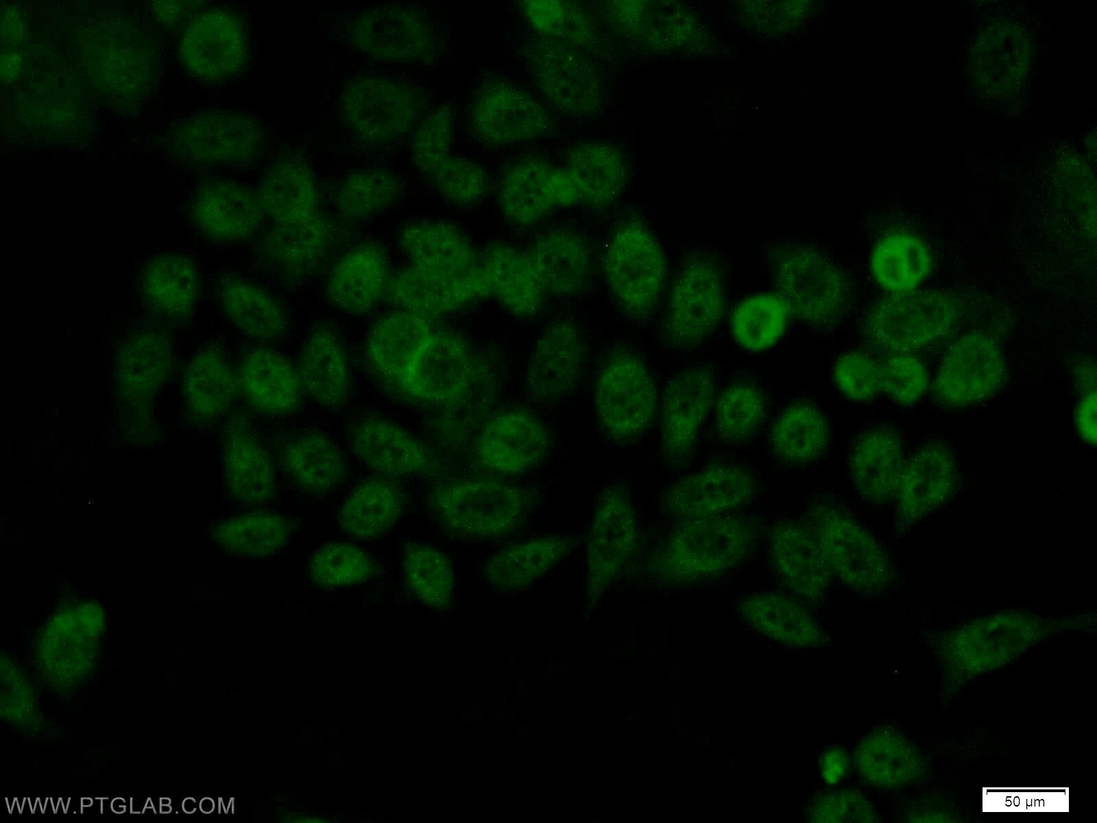 IF Staining of MCF-7 using 10414-1-AP