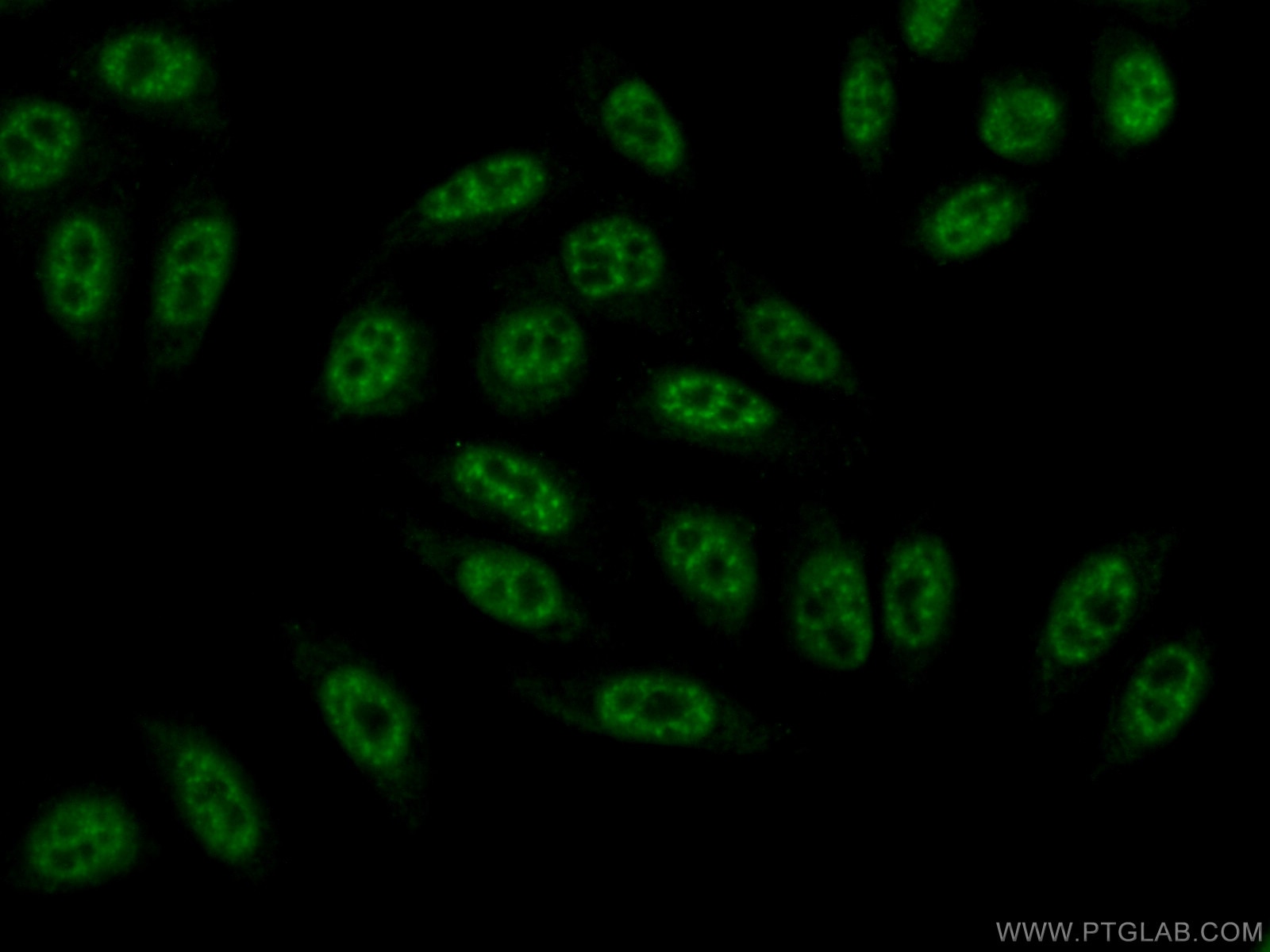 Immunofluorescence (IF) / fluorescent staining of HepG2 cells using BCAS2 Polyclonal antibody (10414-1-AP)