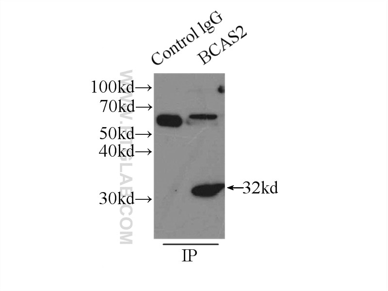 Immunoprecipitation (IP) experiment of mouse brain tissue using BCAS2 Polyclonal antibody (10414-1-AP)