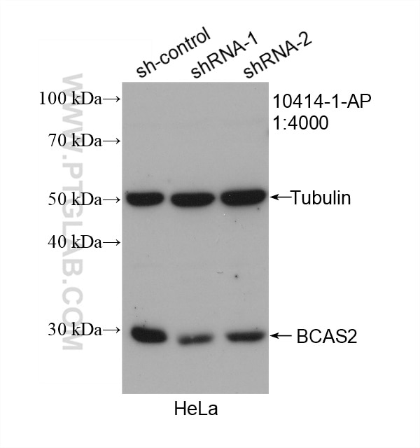 Western Blot (WB) analysis of HeLa cells using BCAS2 Polyclonal antibody (10414-1-AP)