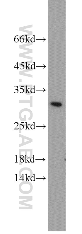 Western Blot (WB) analysis of human brain tissue using BCAS2 Polyclonal antibody (10414-1-AP)