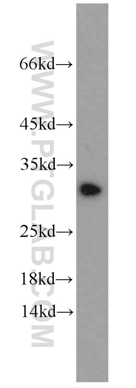 Western Blot (WB) analysis of COS-7 cells using BCAS2 Polyclonal antibody (10414-1-AP)