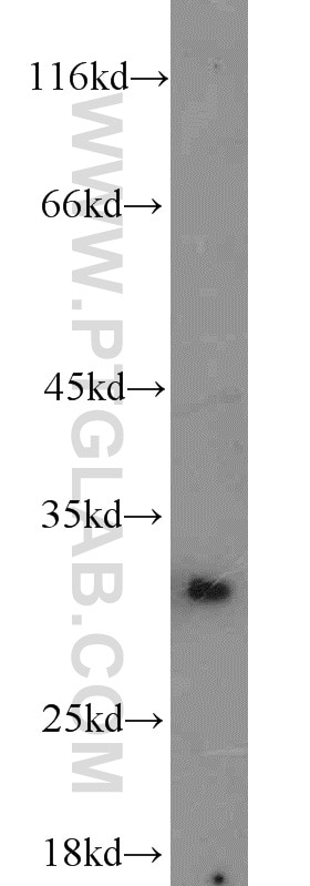 Western Blot (WB) analysis of mouse brain tissue using BCAS2 Polyclonal antibody (10414-1-AP)