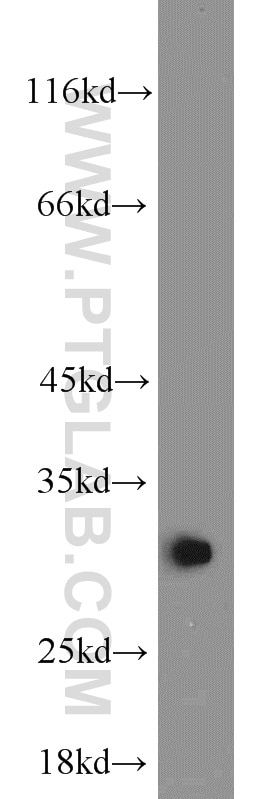 Western Blot (WB) analysis of mouse liver tissue using BCAS2 Polyclonal antibody (10414-1-AP)