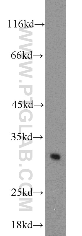 Western Blot (WB) analysis of hESC cells using BCAS2 Polyclonal antibody (10414-1-AP)