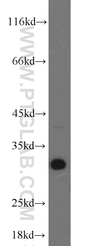 Western Blot (WB) analysis of HeLa cells using BCAS2 Polyclonal antibody (10414-1-AP)