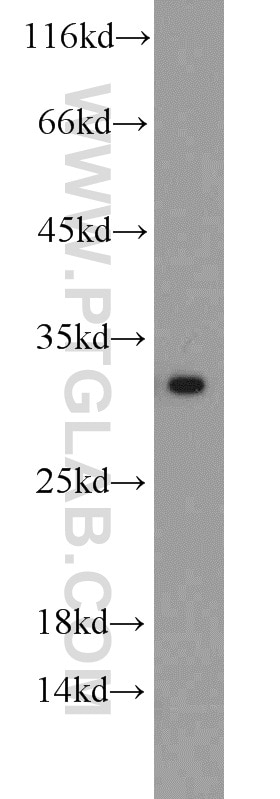 Western Blot (WB) analysis of SH-SY5Y cells using BCAS2 Polyclonal antibody (10414-1-AP)