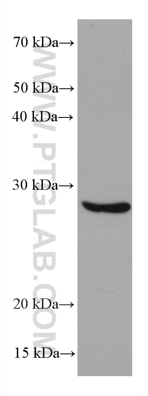 Western Blot (WB) analysis of LNCaP cells using BCAS2 Monoclonal antibody (68003-1-Ig)