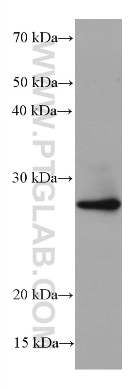 Western Blot (WB) analysis of HEK-293 cells using BCAS2 Monoclonal antibody (68003-1-Ig)