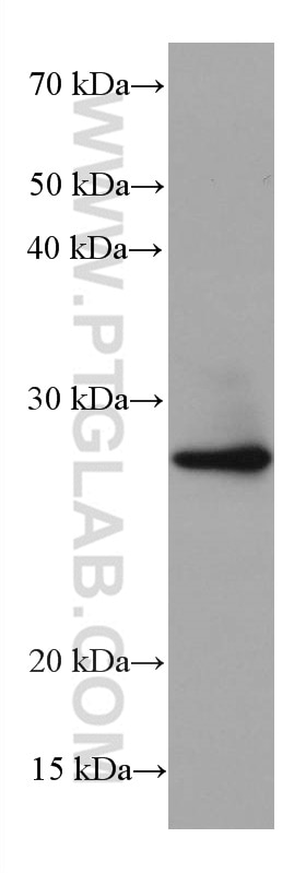 WB analysis of HEK-293 using 68003-1-Ig