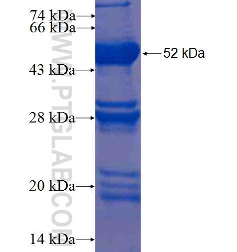 BCAS2 fusion protein Ag0669 SDS-PAGE
