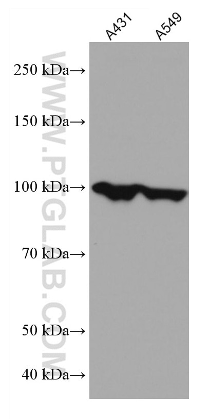 Western Blot (WB) analysis of various lysates using BCAS3 Monoclonal antibody (67085-1-Ig)