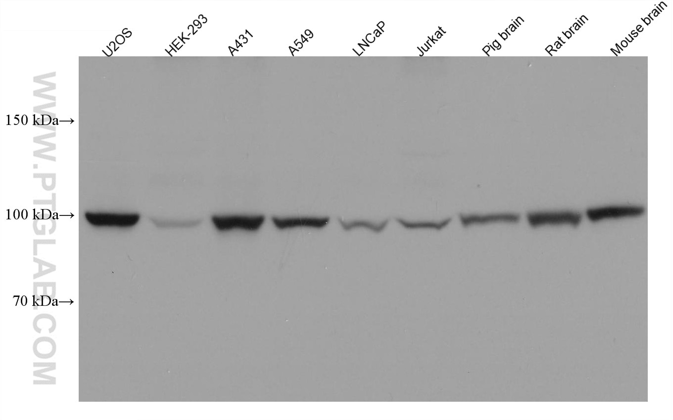 Western Blot (WB) analysis of various lysates using BCAS3 Monoclonal antibody (67085-1-Ig)