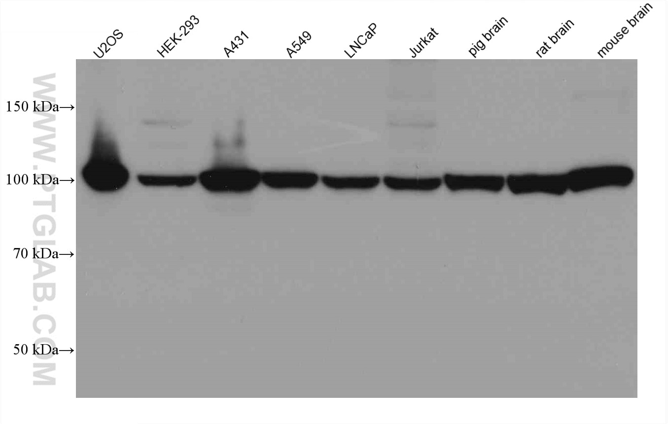 Western Blot (WB) analysis of various lysates using BCAS3 Monoclonal antibody (67085-1-Ig)
